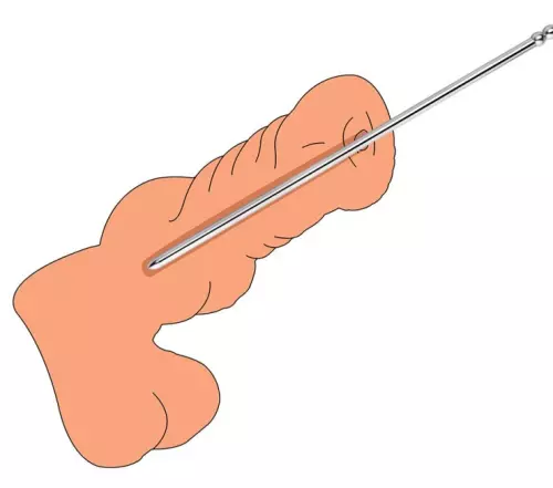 Stab Pronc L 24 cm - Durchmesser 10mm – 4/5