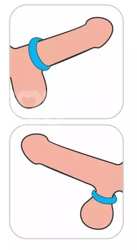 Cockring Ridge Bump Stretcher 25 mm Blau – 8/8
