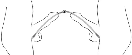 Doppelte flexible Harnröhrenstange Flexi Duo 15cm - Durchmesser 8mm – 2/4