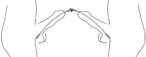 Doppelte flexible Harnröhrenstange Flexi Duo 24cm - Durchmesser 8mm – 2/3