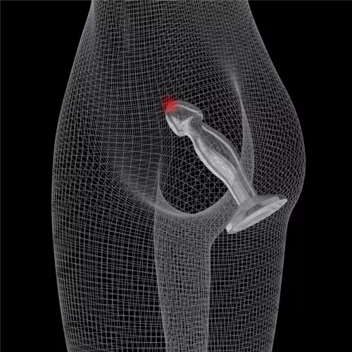 Prostata-Butt Plug Flawless 14 x 4cm – 9/12