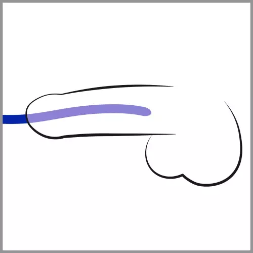 3er-Pack Silikon-Harnröhrenstäbe Blau 16cm - Durchmesser 7-12mm – 3/3